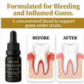 Load image into Gallery viewer, Before and after illustration of bleeding and inflamed gums improving naturally