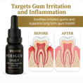 Load image into Gallery viewer, before-after-gum-disease-gingivitis-treatment